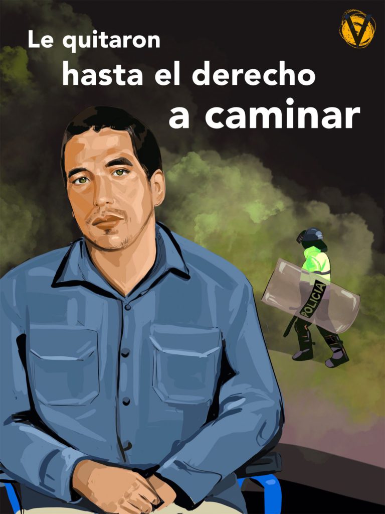 Le quitaron el derecho a caminar